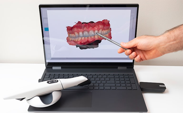 Scanner intraorale DentalBiotech